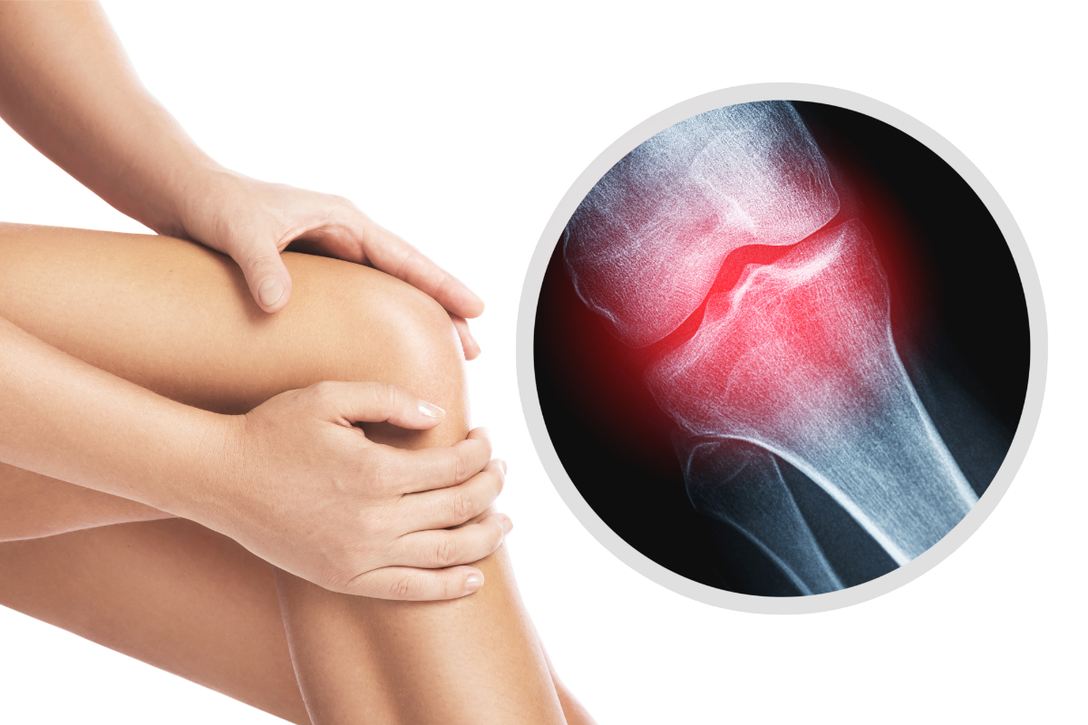 Supplements for Joint Pain